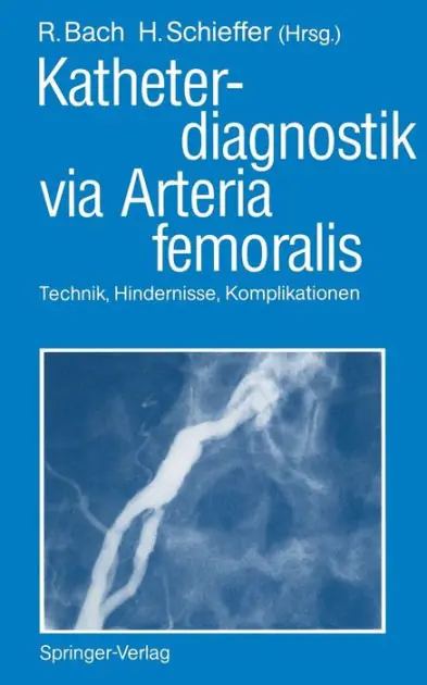 Brand New Katheterdiagnostik via Arteria femoralis: Technik, Hindernisse, Komplikationen