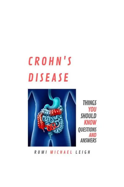 Get Yours Crohn's disease: Things You Should Know (Questions and Answers)