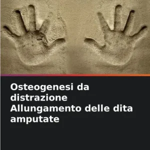 Factory Price Osteogenesi da distrazione Allungamento delle dita amputate