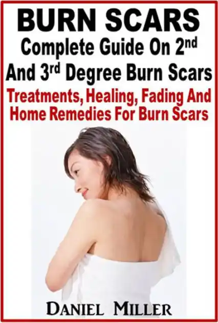 Secure Checkout Burn Scars : Complete Guide On 2nd And 3rd Degree Burn Scars
