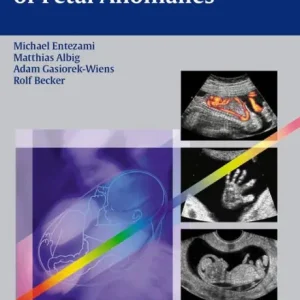 Ultrasound Diagnosis of Fetal Anomalies Deal