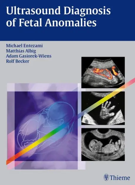 Ultrasound Diagnosis of Fetal Anomalies Deal
