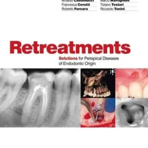 Top Pick Retreatment. Solutions for Apical Diseases of Endodontic Origin