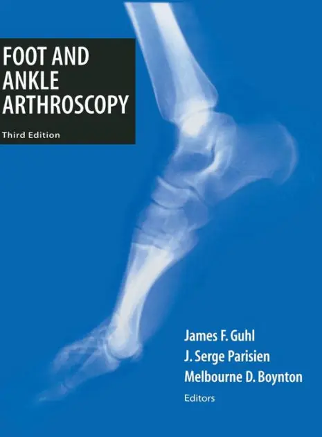 Must Have Foot and Ankle Arthroscopy