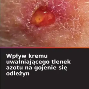 Wplyw kremu uwalniającego tlenek azotu na gojenie się odleżyn Free Delivery