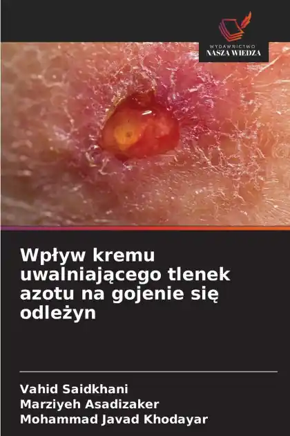 Wplyw kremu uwalniającego tlenek azotu na gojenie się odleżyn Free Delivery
