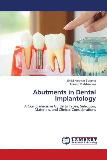 Abutments in Dental Implantology Today Only