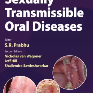 Sexually Transmissible Oral Diseases Seasonal Sale
