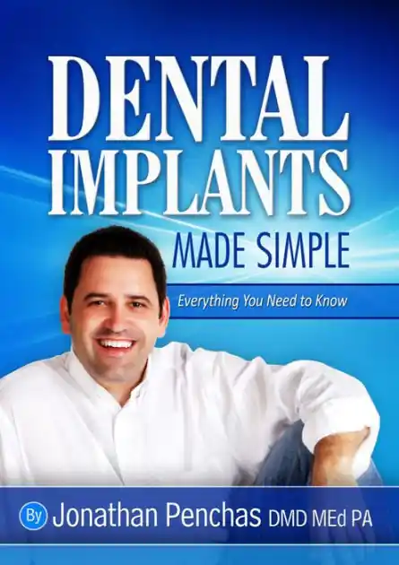 Mega Sale Dental Implants Made Simple
