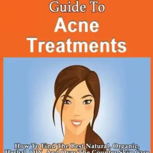 The Smart & Easy Guide To Acne Treatments: How To Find The Best Natural, Organic, Herbal, DIY, And Over The Counter Skin Care Treatments & Creams To Successfully Fight Acne & Acne Scars At All Stages Top Pick