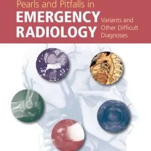 Sale Pearls and Pitfalls in Emergency Radiology: Variants and Other Difficult Diagnoses