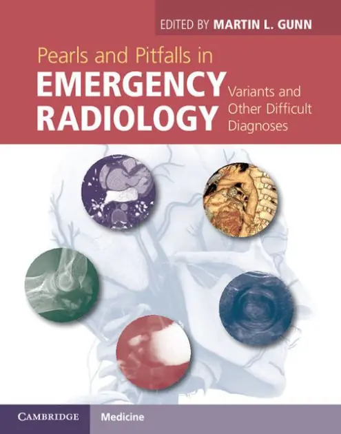 Sale Pearls and Pitfalls in Emergency Radiology: Variants and Other Difficult Diagnoses