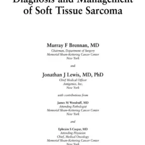 Super Sale Diagnosis and Management of Soft Tissue Sarcoma