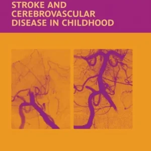 Free Returns Stroke and Cerebrovascular Disease in Childhood