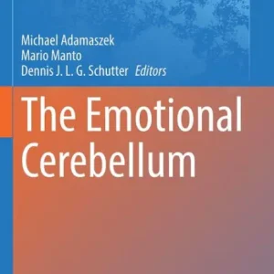 Modern The Emotional Cerebellum