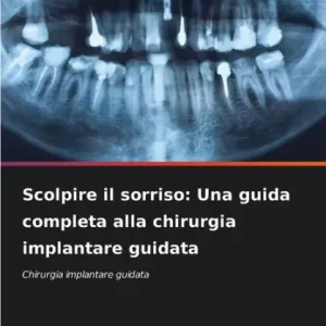 Express Delivery Scolpire il sorriso: Una guida completa alla chirurgia implantare guidata