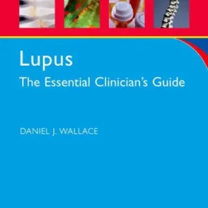 Top Pick Lupus: The Essential Clinician's Guide