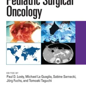 Bargain Pediatric Surgical Oncology