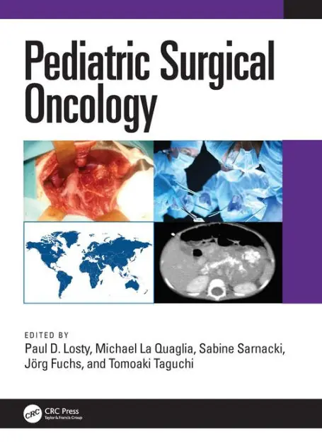 Bargain Pediatric Surgical Oncology