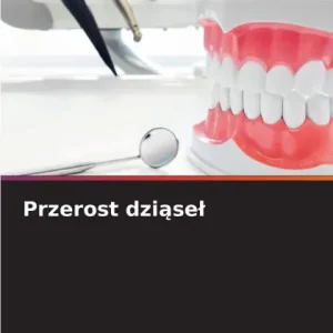 Przerost dziąsel Hassle-Free Returns