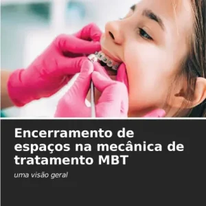 Encerramento de espaÃ¯Â¿Â½os na mecÃ¯Â¿Â½nica de tratamento MBT Viral